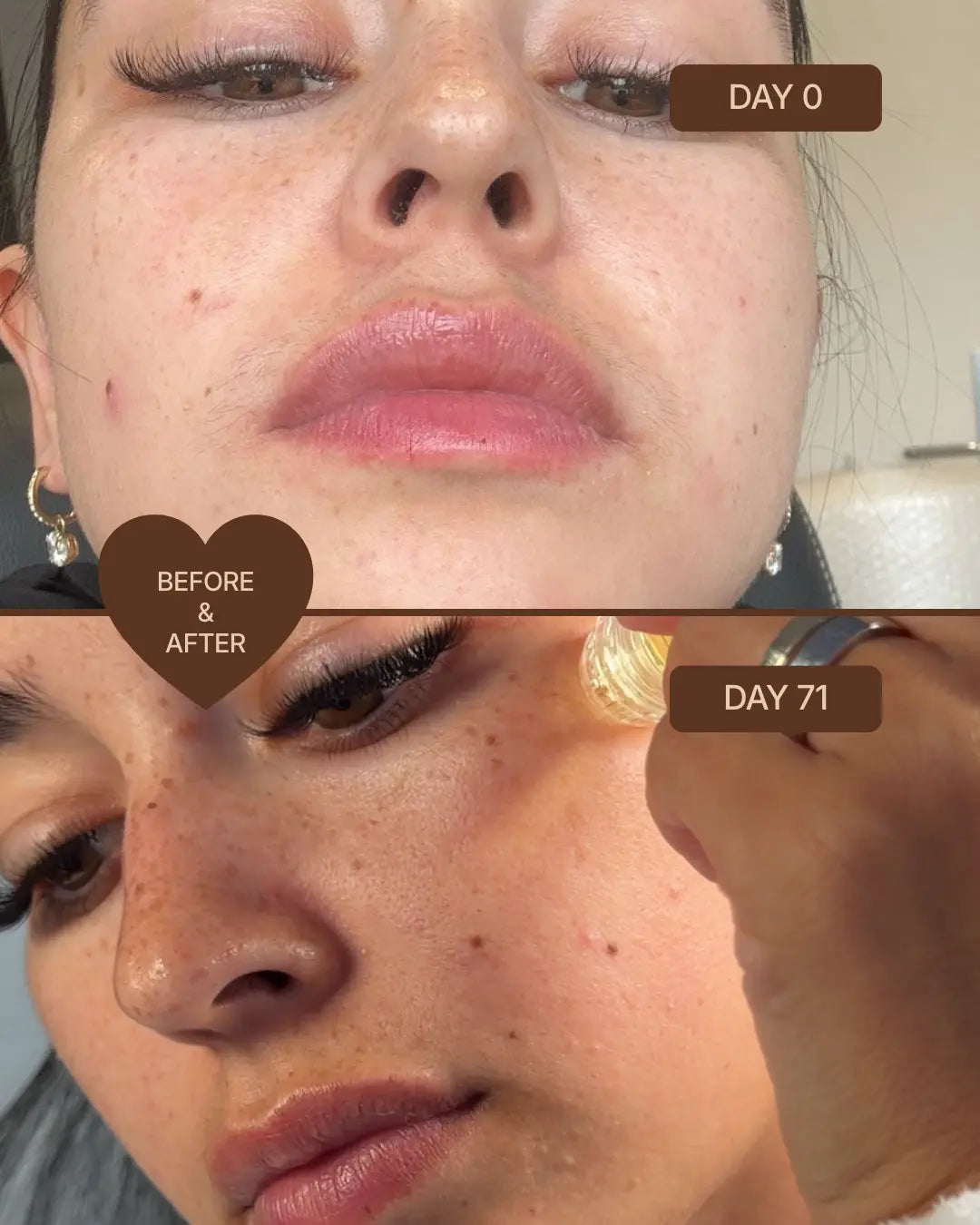 Skin Micro-Infusion Peptide System - GHK-Cu 0.05%