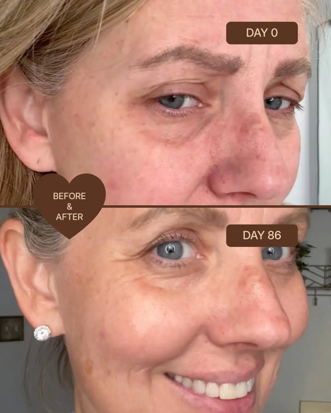 Skin Micro-Infusion Peptide System - GHK-Cu 0.05%