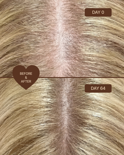 Hair Micro-Infusion Peptide System - Hyaluronic Acid 5%