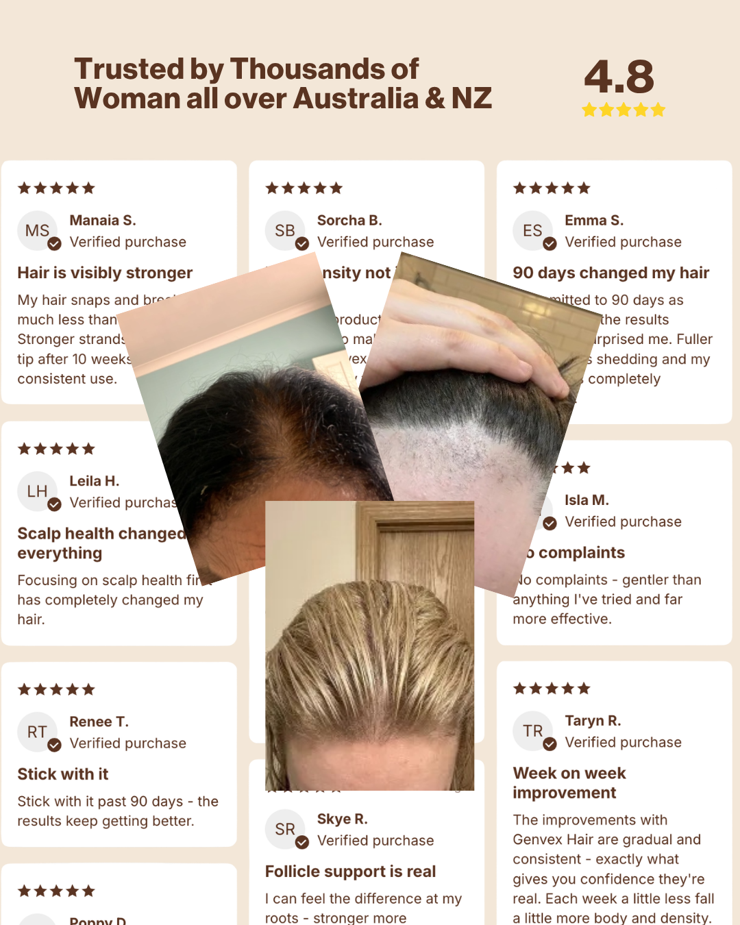 Hair Micro-Infusion Peptide System - Hyaluronic Acid 5%