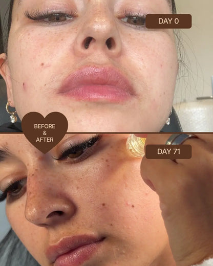 Skin Micro-Infusion Peptide System - GHK-Cu 0.05%