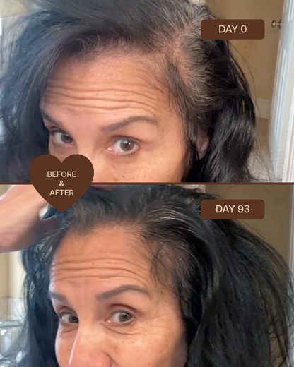 Hair Micro-Infusion Peptide System - Hyaluronic Acid 5%