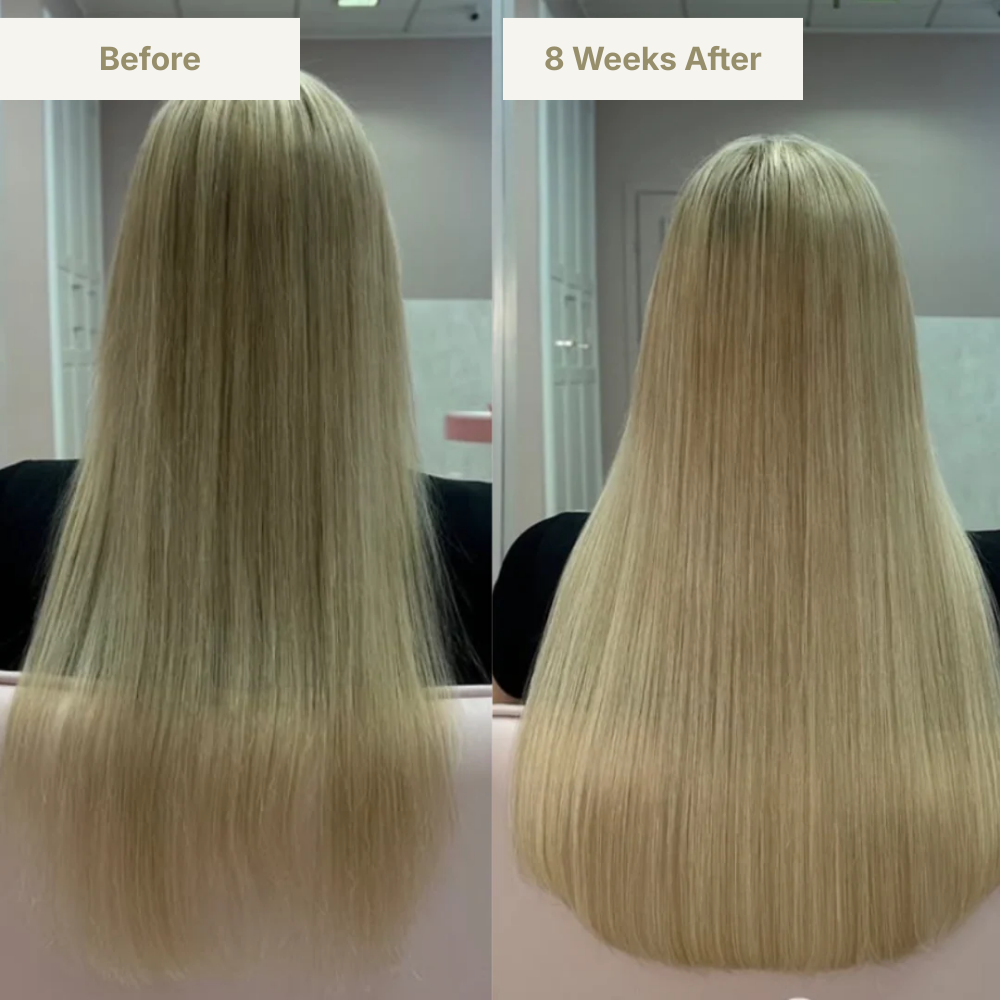 GENVEX™ Micro-Infusion System for Thicker, Healthier Hair