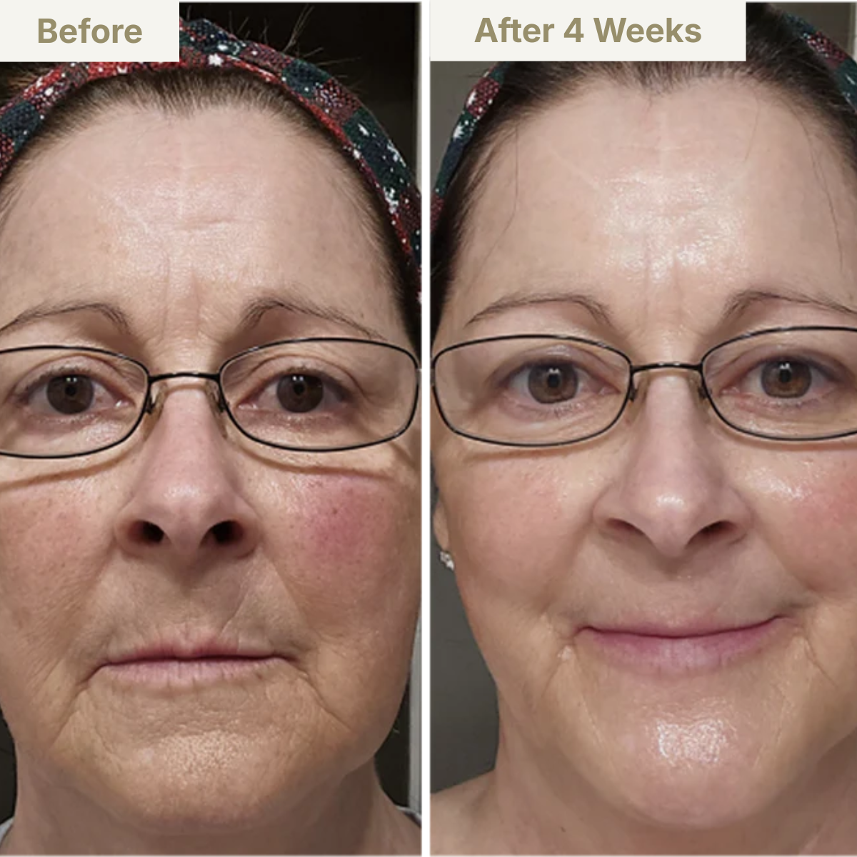 GENVEX™ Micro-Infusion System for Radiant, Youthful Skin