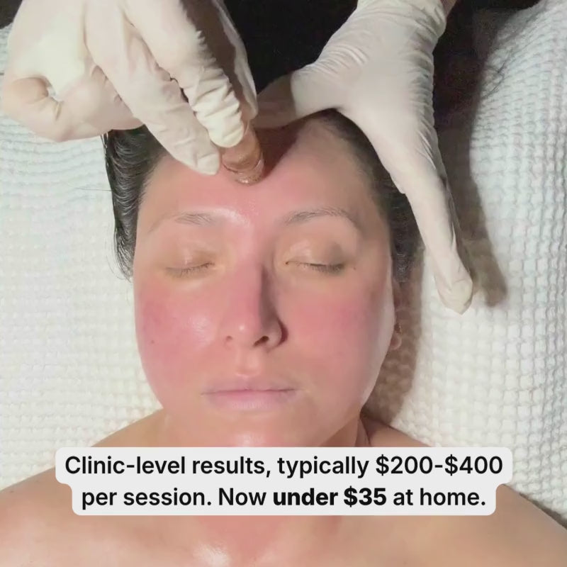 Load video: GENVEX™ Micro-Infusion System for Radiant, Youthful Skin